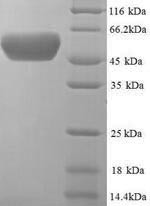 (Tris-Glycine gel) Discontinuous SDS-PAGE (reduced) with 5% enrichment gel and 15% separation gel.