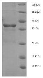 (Tris-Glycine gel) Discontinuous SDS-PAGE (reduced) with 5% enrichment gel and 15% separation gel.