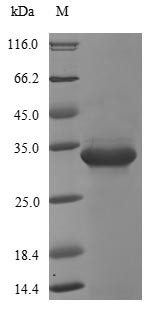 (Tris-Glycine gel) Discontinuous SDS-PAGE (reduced) with 5% enrichment gel and 15% separation gel.