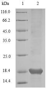 (Tris-Glycine gel) Discontinuous SDS-PAGE (reduced) with 5% enrichment gel and 15% separation gel.