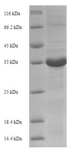 (Tris-Glycine gel) Discontinuous SDS-PAGE (reduced) with 5% enrichment gel and 15% separation gel.