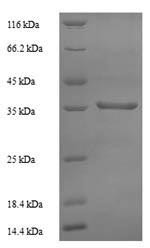 (Tris-Glycine gel) Discontinuous SDS-PAGE (reduced) with 5% enrichment gel and 15% separation gel.