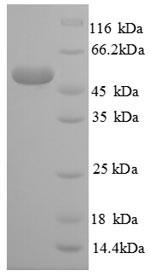 (Tris-Glycine gel) Discontinuous SDS-PAGE (reduced) with 5% enrichment gel and 15% separation gel.