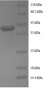 (Tris-Glycine gel) Discontinuous SDS-PAGE (reduced) with 5% enrichment gel and 15% separation gel.