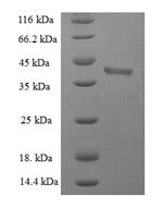 (Tris-Glycine gel) Discontinuous SDS-PAGE (reduced) with 5% enrichment gel and 15% separation gel.