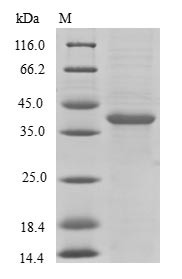 (Tris-Glycine gel) Discontinuous SDS-PAGE (reduced) with 5% enrichment gel and 15% separation gel.