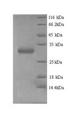 (Tris-Glycine gel) Discontinuous SDS-PAGE (reduced) with 5% enrichment gel and 15% separation gel.