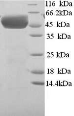 (Tris-Glycine gel) Discontinuous SDS-PAGE (reduced) with 5% enrichment gel and 15% separation gel.