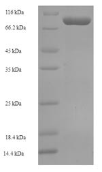 (Tris-Glycine gel) Discontinuous SDS-PAGE (reduced) with 5% enrichment gel and 15% separation gel.
