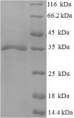 (Tris-Glycine gel) Discontinuous SDS-PAGE (reduced) with 5% enrichment gel and 15% separation gel.