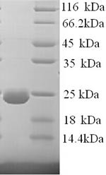 (Tris-Glycine gel) Discontinuous SDS-PAGE (reduced) with 5% enrichment gel and 15% separation gel.