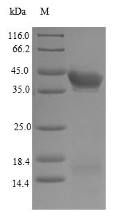 (Tris-Glycine gel) Discontinuous SDS-PAGE (reduced) with 5% enrichment gel and 15% separation gel.