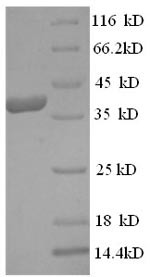 (Tris-Glycine gel) Discontinuous SDS-PAGE (reduced) with 5% enrichment gel and 15% separation gel.