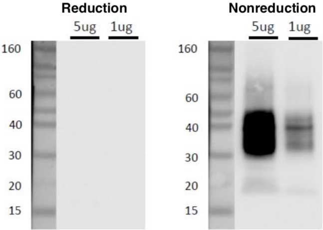 Figure 2. Western blot analysis of CD63 in C32 cell exosomes with anti-CD63 (8A12) antibody.
Sample: C32 cell exosomes (5ug, 1ug)
Primary antibody: anti-CD63 (8A12) (1ug/mL)
Secondary antibody: anti-mouse IgG-HRP