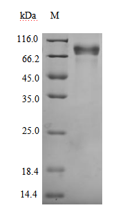 (Tris-Glycine gel) Discontinuous SDS-PAGE (reduced) with 5% enrichment gel and 15% separation gel.