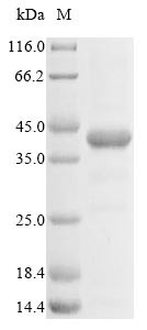 (Tris-Glycine gel) Discontinuous SDS-PAGE (reduced) with 5% enrichment gel and 15% separation gel.