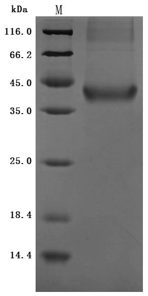 (Tris-Glycine gel) Discontinuous SDS-PAGE (reduced) with 5% enrichment gel and 15% separation gel.