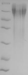 (Tris-Glycine gel) Discontinuous SDS-PAGE (reduced) with 5% enrichment gel and 15% separation gel.