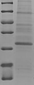 (Tris-Glycine gel) Discontinuous SDS-PAGE (reduced) with 5% enrichment gel and 15% separation gel.