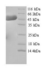 (Tris-Glycine gel) Discontinuous SDS-PAGE (reduced) with 5% enrichment gel and 15% separation gel.
