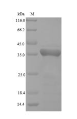 (Tris-Glycine gel) Discontinuous SDS-PAGE (reduced) with 5% enrichment gel and 15% separation gel.
