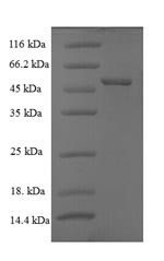 (Tris-Glycine gel) Discontinuous SDS-PAGE (reduced) with 5% enrichment gel and 15% separation gel.