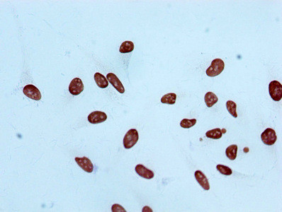 Immunocytochemistry analysis of CSB-RA010418A04me2HU diluted at 1:100 and staining in Hela cells performed on a Leica BondTM system. After dewaxing and hydration, antigen retrieval was mediated by high pressure in a citrate buffer (pH 6.0). Section was blocked with 10% normal goat serum 30min at RT. Then primary antibody (1% BSA) was incubated at 4℃ overnight. The primary is detected by a biotinylated secondary antibody and visualized using an HRP conjugated SP system.