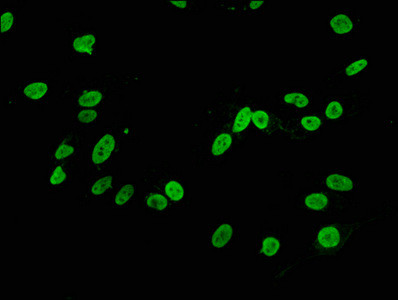 Immunofluorescence staining of Hela cells with CSB-RA010418A04me2HU at 1:34,counter-stained with DAPI. The cells were fixed in 4% formaldehyde, permeabilized using 0.2% Triton X-100 and blocked in 10% normal Goat Serum. The cells were then incubated with the antibody overnight at 4℃.The secondary antibody was Alexa Fluor 488-congugated AffiniPure Goat Anti-Rabbit IgG (H+L).