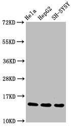 Western Blot<br />Positive WB detected in Hela whole cell lysate锛孒epG2 whole cell lysate锛孲H-SY5Y whole cell lysate<br />All lanes Mono-methyl-Histone H3.1(R17)antibody at 1.55μg/ml<br />Secondary<br />Goat polyclonal to rabbit IgG at 1/50000 dilution<br />Predicted band size: 15 KDa<br />Observed band size: 15 KDa<br />