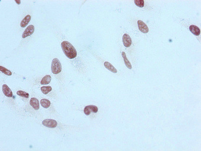Immunocytochemistry analysis of CSB-RA010418A17me1HU diluted at 1:100 and staining in Hela cells performed on a Leica BondTM system. After dewaxing and hydration, antigen retrieval was mediated by high pressure in a citrate buffer (pH 6.0). Section was blocked with 10% normal goat serum 30min at RT. Then primary antibody (1% BSA) was incubated at 4℃ overnight. The primary is detected by a biotinylated secondary antibody and visualized using an HRP conjugated SP system.