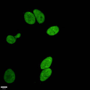 Immunofluorescence staining of Hela cells withCSB-RA010418A17me1HU at 1:96,counter-stained with DAPI. The cells were fixed in 4% formaldehyde, permeabilized using 0.2% Triton X-100 and blocked in 10% normal Goat Serum. The cells were then incubated with the antibody overnight at 4℃.The secondary antibody was Alexa Fluor 488-congugated AffiniPure Goat Anti-Rabbit IgG (H+L).