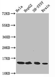 Western Blot<br />
Positive WB detected in Hela whole cell lysate锛孒epG2 whole cell lysate锛孲H-SY5Y whole cell lysate锛孯at brain tissue<br />
All lanes Acetyl-Histone H3.1(K14)antibody at 0.75μg/ml<br />
Secondary<br />
Goat polyclonal to rabbit IgG at 1/50000 dilution<br />
Predicted band size: 15 KDa<br />
Observed band size: 15 KDa<br />