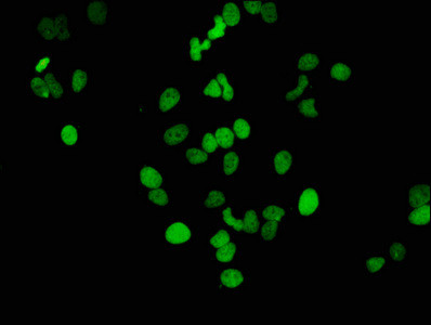 Immunofluorescence staining of Hela cells(treated by 15mM sodium butyrate for 30min) with CSB-RA010418A14acHU at 1:46,counter-stained with DAPI. The cells were fixed in 4% formaldehyde, permeabilized using 0.2% Triton X-100 and blocked in 10% normal Goat Serum. The cells were then incubated with the antibody overnight at 4℃.The secondary antibody was Alexa Fluor 488-congugated AffiniPure Goat Anti-Rabbit IgG (H+L).