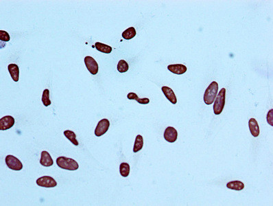 Immunocytochemistry analysis of CSB-RA010429A05acHU diluted at 1:100 and staining in Hela cells performed on a Leica BondTM system. After dewaxing and hydration, antigen retrieval was mediated by high pressure in a citrate buffer (pH 6.0). Section was blocked with 10% normal goat serum 30min at RT. Then primary antibody (1% BSA) was incubated at 4℃ overnight. The primary is detected by a biotinylated secondary antibody and visualized using an HRP conjugated SP system.