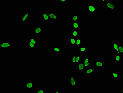 Immunofluorescence staining of Hela cells(treated by 15mM sodium butyrate for 30min) with CSB-RA010429A05acHU at 1:65,counter-stained with DAPI. The cells were fixed in 4% formaldehyde, permeabilized using 0.2% Triton X-100 and blocked in 10% normal Goat Serum. The cells were then incubated with the antibody overnight at 4℃.The secondary antibody was Alexa Fluor 488-congugated AffiniPure Goat Anti-Rabbit IgG (H+L).