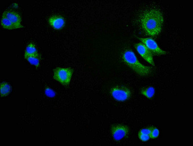 Immunofluorescence staining of MCF-7 cells with CSB-RA004969A0HU at 1:34,counter-stained with DAPI. The cells were fixed in 4% formaldehyde, permeabilized using 0.2% Triton X-100 and blocked in 10% normal Goat Serum. The cells were then incubated with the antibody overnight at 4℃.The secondary antibody was Alexa Fluor 488-congugated AffiniPure Goat Anti-Rabbit IgG (H+L).