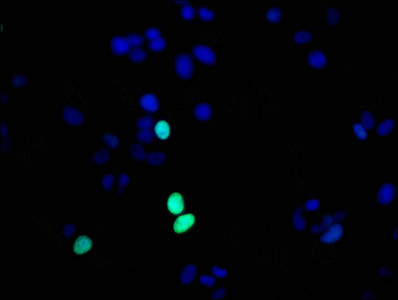 Immunofluorescence staining of MCF-7 cells with CSB-RA010380A17phHU at 1:56,counter-stained with DAPI. The cells were fixed in 4% formaldehyde, permeabilized using 0.2% Triton X-100 and blocked in 10% normal Goat Serum. The cells were then incubated with the antibody overnight at 4℃.The secondary antibody was Alexa Fluor 488-congugated AffiniPure Goat Anti-Rabbit IgG (H+L).