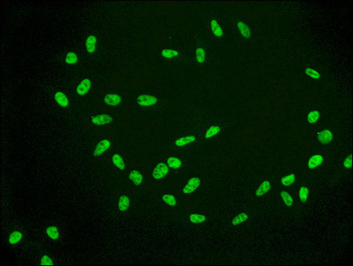 Immunofluorescence staining of Hela cells(treated by 15mM sodium butyrate for 30min) with CSB-RA010385A09acHU at 1:56,counter-stained with DAPI. The cells were fixed in 4% formaldehyde, permeabilized using 0.2% Triton X-100 and blocked in 10% normal Goat Serum. The cells were then incubated with the antibody overnight at 4℃.The secondary antibody was Alexa Fluor 488-congugated AffiniPure Goat Anti-Rabbit IgG (H+L).