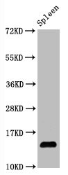 Western Blot<br />Positive WB detected in Mouse spleen tissueAll lanes Hydroxyl-Histone H2A type 1-B/E (Y39) antibody at 1.05μg/ml<br />Secondary<br />Goat polyclonal to rabbit IgG at 1/50000 dilution<br />Predicted band size: 14 KDa<br />Observed band size: 14 KDa<br />