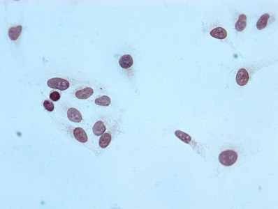 Immunocytochemistry analysis of CSB-RA010429A20me3HU diluted at 1:100 and staining in Hela cells performed on a Leica BondTM system. After dewaxing and hydration, antigen retrieval was mediated by high pressure in a citrate buffer (pH 6.0). Section was blocked with 10% normal goat serum 30min at RT. Then primary antibody (1% BSA) was incubated at 4℃ overnight. The primary is detected by a biotinylated secondary antibody and visualized using an HRP conjugated SP system.