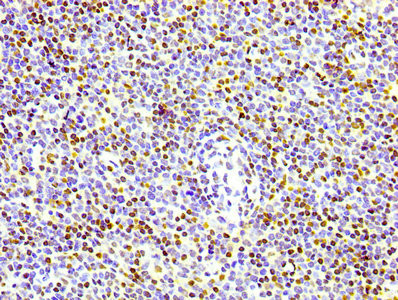IHC image of CSB-RA010109A0HU diluted at 1:100 and staining in paraffin-embedded human lymph node tissue performed on a Leica BondTM system. After dewaxing and hydration, antigen retrieval was mediated by high pressure in a citrate buffer (pH 6.0). Section was blocked with 10% normal goat serum 30min at RT. Then primary antibody (1% BSA) was incubated at 4℃ overnight. The primary is detected by a biotinylated secondary antibody and visualized using an HRP conjugated SP system.