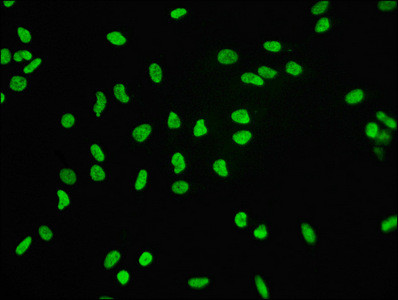 Immunofluorescence staining of Hela cells with CSB-RA010109A0HU at 1:60,counter-stained with DAPI. The cells were fixed in 4% formaldehyde, permeabilized using 0.2% Triton X-100 and blocked in 10% normal Goat Serum. The cells were then incubated with the antibody overnight at 4℃.The secondary antibody was Alexa Fluor 488-congugated AffiniPure Goat Anti-Rabbit IgG (H+L).