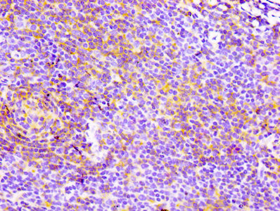 IHC image of CSB-RA004935A0HU diluted at 1:100 and staining in paraffin-embedded human lymph node tissue performed on a Leica BondTM system. After dewaxing and hydration, antigen retrieval was mediated by high pressure in a citrate buffer (pH 6.0). Section was blocked with 10% normal goat serum 30min at RT. Then primary antibody (1% BSA) was incubated at 4℃ overnight. The primary is detected by a biotinylated secondary antibody and visualized using an HRP conjugated SP system.