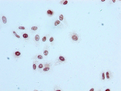 Immunocytochemistry analysis of CSB-RA010418A56acHU diluted at 1:100 and staining in HepG2 cells performed on a Leica BondTM system. After dewaxing and hydration, antigen retrieval was mediated by high pressure in a citrate buffer (pH 6.0). Section was blocked with 10% normal goat serum 30min at RT. Then primary antibody (1% BSA) was incubated at 4℃ overnight. The primary is detected by a biotinylated secondary antibody and visualized using an HRP conjugated SP system.