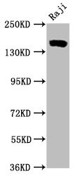 Western Blot<br />Positive WB detected in Raji whole cell lysate<br />All lanes CD21 antibody at 0.55μg/ml<br />Secondary<br />Goat polyclonal to rabbit IgG at 1/50000 dilution<br />Predicted band size: 155 KDa<br />Observed band size: 155 KDa<br />