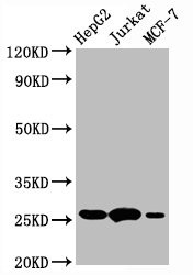 Western Blot<br />Positive WB detected in:HepG2 whole cell lysate,Jurkat whole cell lysate,MCF-7 whole cell lysate<br />All lanes:BCL2 antibody at 1&mu;g/ml<br />Secondary<br />Goat polyclonal to rabbit IgG at 1/50000 dilution<br />Predicted band size: 26 KDa<br />Observed band size: 26 KDa<br />&nbsp;