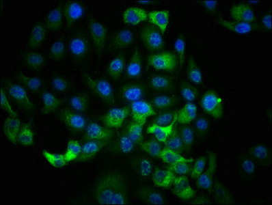 Immunofluorescence staining of Hela cells with CSB-RA618984A359phHU at 1:100,counter-stained with DAPI. The cells were fixed in 4% formaldehyde, permeabilized using 0.2% Triton X-100 and blocked in 10% normal Goat Serum. The cells were then incubated with the antibody overnight at 4℃. The secondary antibody was Alexa Fluor 488-congugated AffiniPure Goat Anti-Rabbit IgG (H+L).