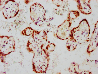 IHC image of CSB-RA009276A308phHU diluted at 1:100 and staining in paraffin-embedded human placenta tissue performed on a Leica BondTM system. After dewaxing and hydration, antigen retrieval was mediated by high pressure in a citrate buffer (pH 6.0). Section was blocked with 10% normal goat serum 30min at RT. Then primary antibody (1% BSA) was incubated at 4℃ overnight. The primary is detected by a biotinylated secondary antibody and visualized using an HRP conjugated SP system.