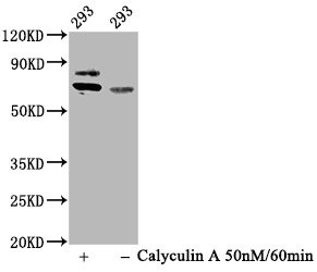 Western Blot<br />
Positive WB detected in 293 whole cell lysate(treated with Calyculin A or not)<br />
All lanes Phospho-RPS6KB1 antibody at 0.93μg/ml<br />
Secondary<br />
Goat polyclonal to rabbit IgG at 1/50000 dilution<br />
Predicted band size: 70 KDa<br />
Observed band size: 70 KDa<br />