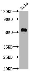 Western Blot<br />Positive WB detected in Hela whole cell lysate<br />All lanes Phospho-MYC antibody at 1.4μg/ml<br />Secondary<br />Goat polyclonal to rabbit IgG at 1/50000 dilution<br />Predicted band size: 57 KDa<br />Observed band size: 57 KDa<br />